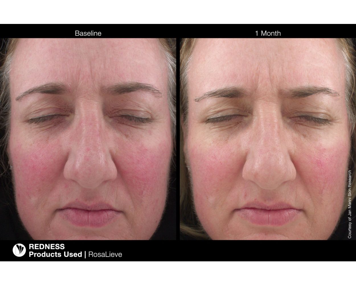 RosaLieve Redness Reducing Complex