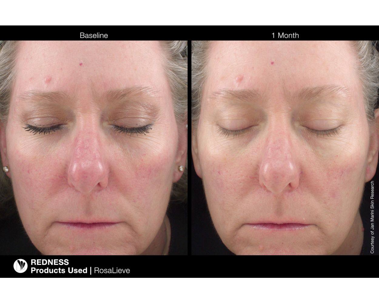 RosaLieve Redness Reducing Complex